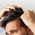 Familiarity-with-the-stages-of-hair-transplantation